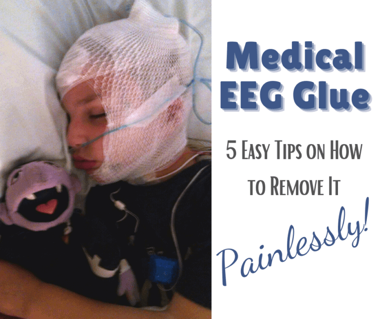 5 “No Tears” Tips to Remove Medical EEG Glue from Hair.
